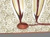 Root Canal