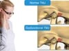 Causes of TMJ/TMD