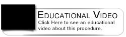 Dental Education Video - Over Denture